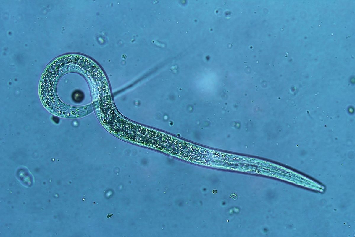Eustrongylides Under A Microscope